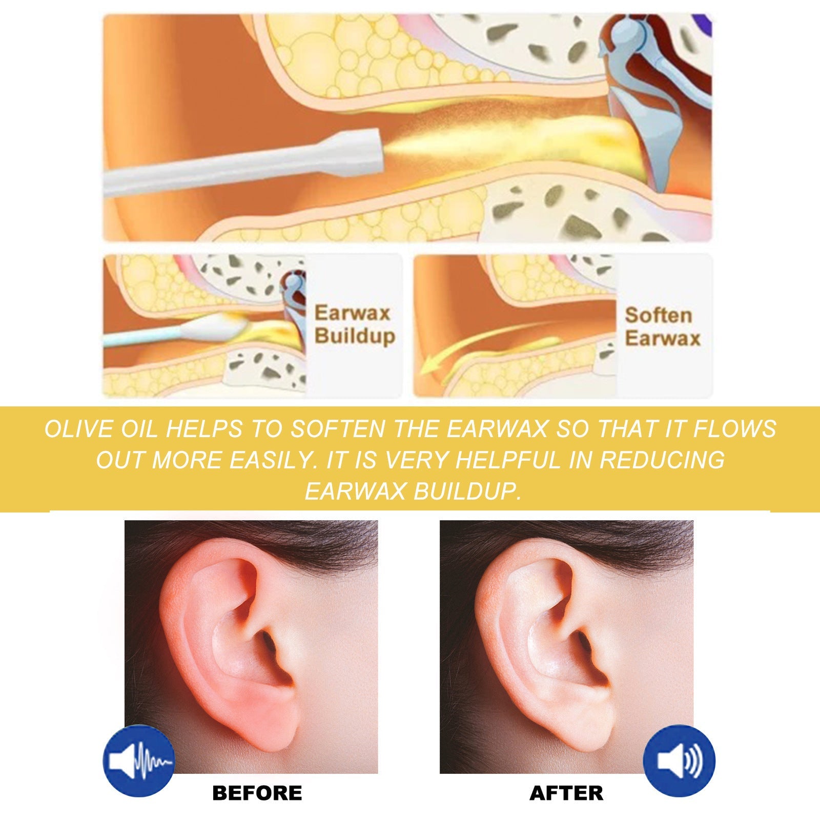 Relieve Tinnitus Discomfort Clean Earwax Ear Drop My Store